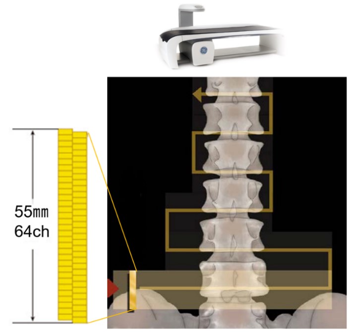 Technical Tips_detector array07.jpg